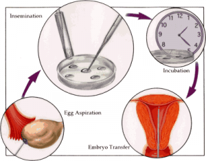 IVF-treatment-cycle