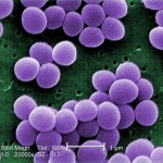 A very high magnification scanning electron micrograph (SEM) of a strain of Staphylococcus aureus bacteria taken from a vancomycin intermediate resistant culture (VISA).