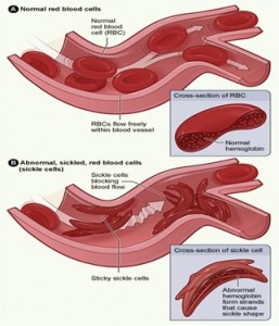 blood-cell-normal-ab-normal