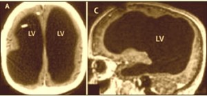 brain-scan2