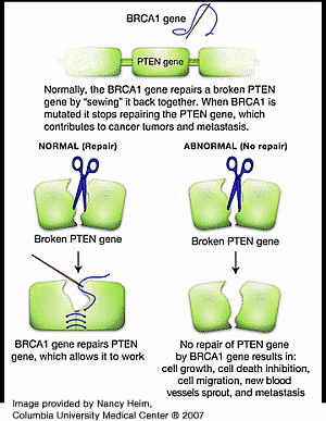 cause-of-breast-cancer