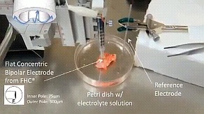 heart-plaque-sensor