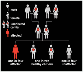 sickle-cell-anemia